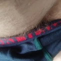 VM28
