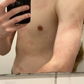 hotass20