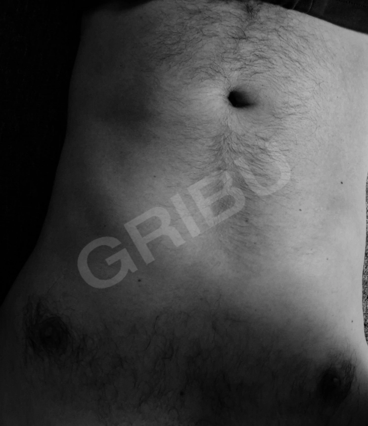 Advertisement (8526533) - Lietus5 1