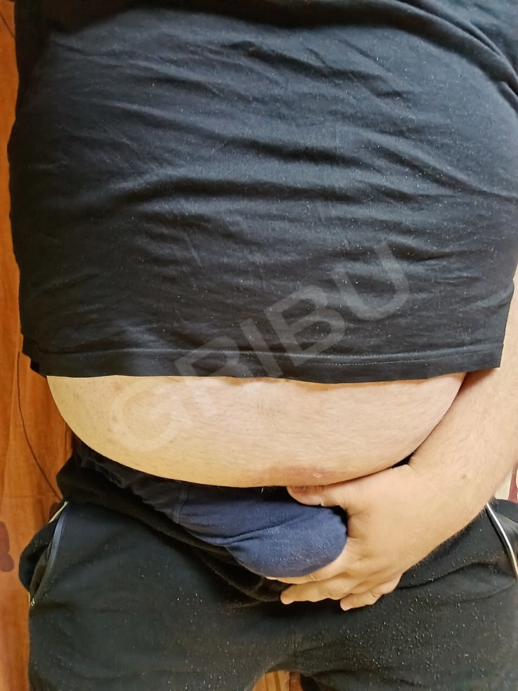 Advertisement (8795943) - BigMan134 1