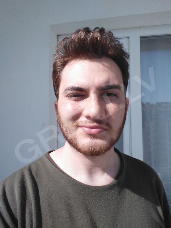 Furkan1903728