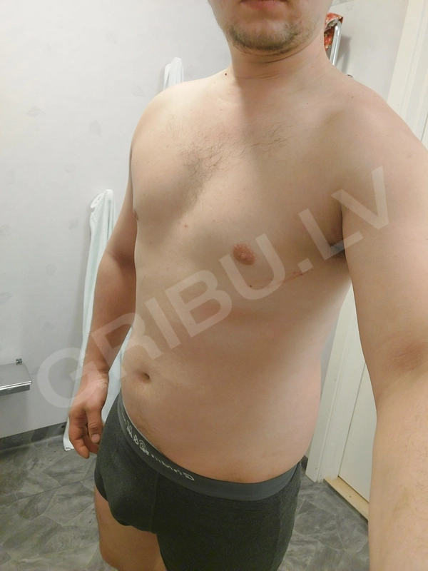 SIHIS2217220