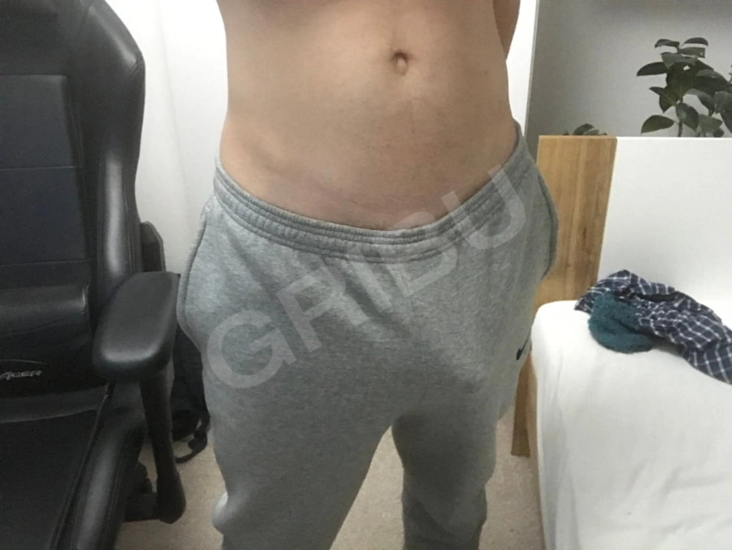 Mobilss2866119