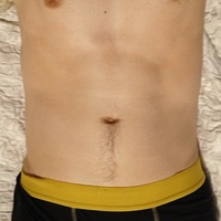Jānis