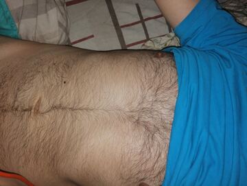 Lauris80