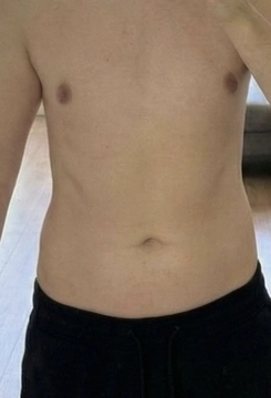 Bottoom